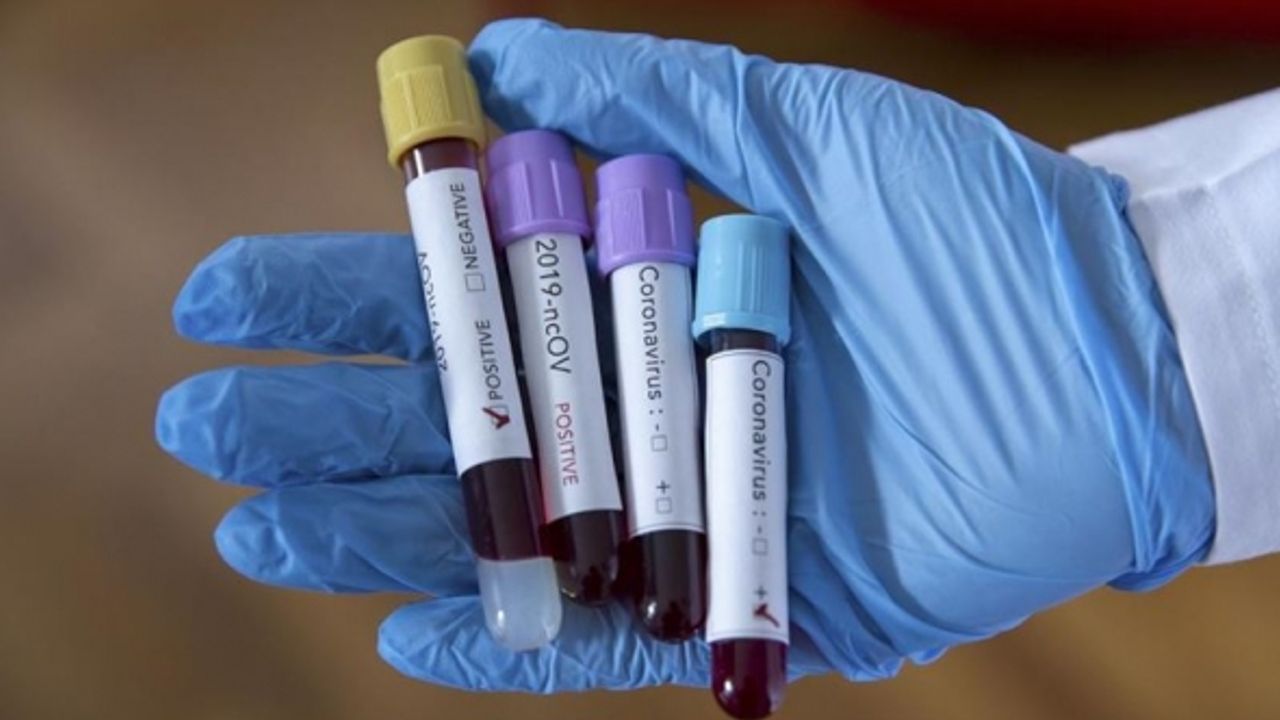 Hollanda 12 yaş altındaki çocuklara koronavirüs testi yapacak