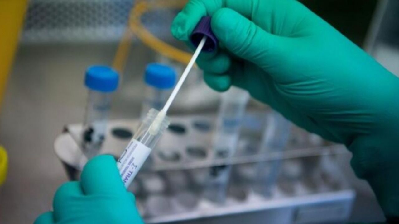 Hollanda’dan Türkiye'ye giden yolcular PCR testini bedava yapabilecek