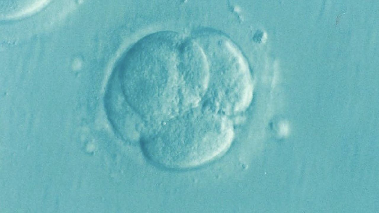 Hollanda’da doğurganlık tedavisinde kendi spermini kullanan doktorun çocuklarında genetik bozukluk tespit edildi