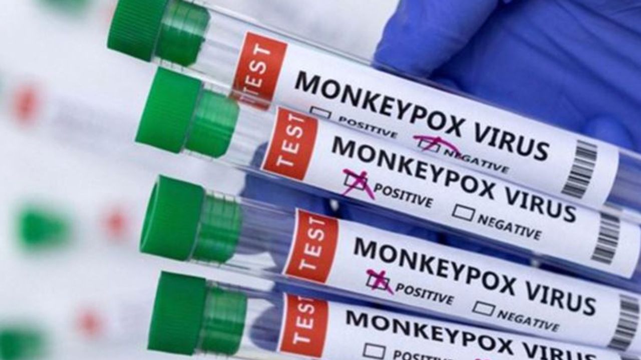 Hollanda'da maymun çiçeği virüsü vaka sayısı bini aştı