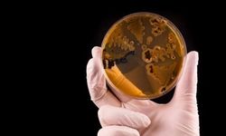 Hollanda’da baş gösteren Salmonella nedir? Belirtileri, korunma yöntemleri ve tedavisi