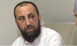 Almanya’da yaşayan Türk, evini basan polisler tarafından feci şekilde darp edildi!