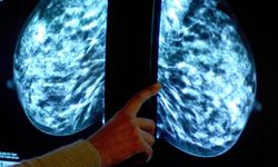 Kanser tedavisinde çığır açan buluş: Hedefli kemoterapi hapı