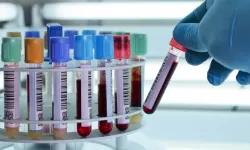 Basit bir kan testi hastalıkları 10 yıl önceden tespit edebiliyor