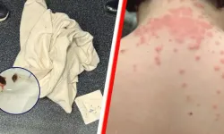 Hollanda aktarmalı uçuşta tahtakurusu iddiasıyla KLM’e 200 bin dolarlık dava