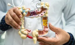 Bağırsak sağlığı için en etkili çözüm: Sofrada yapılan küçük değişiklikler