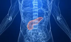 Pankreas kanserinde erken teşhisi kolaylaştıracak yeni kan testi