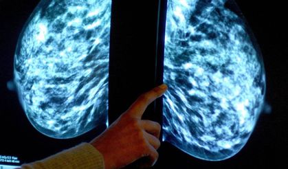 Kanser tedavisinde çığır açan buluş: Hedefli kemoterapi hapı