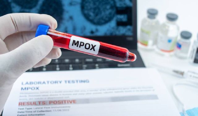 Mpox virüsü yayılıyor, uzmanlar ise paniğe gerek yok mesajı veriyor