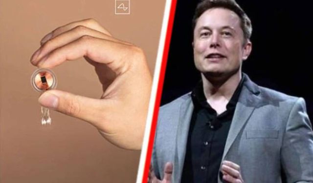 Dünya’da 12 kişiye Elon Musk’ın beyin çipi yerleştirildi