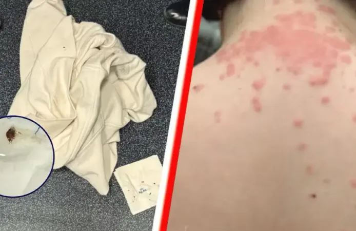 Hollanda aktarmalı uçuşta tahtakurusu iddiasıyla KLM’e 200 bin dolarlık dava