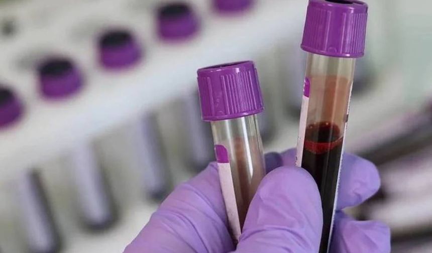 Hollanda’da otizm tedavisinde göbek kordonu kanı kullanan doktora yasak