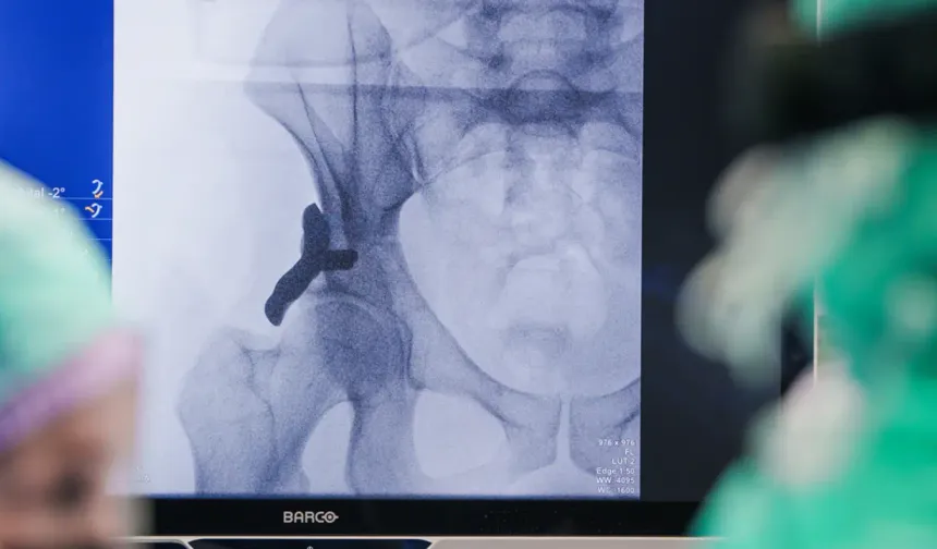 Dünyada bir ilk: Hollanda’da 3D yazıcıyla üretilen kalça implantı insana takıldı