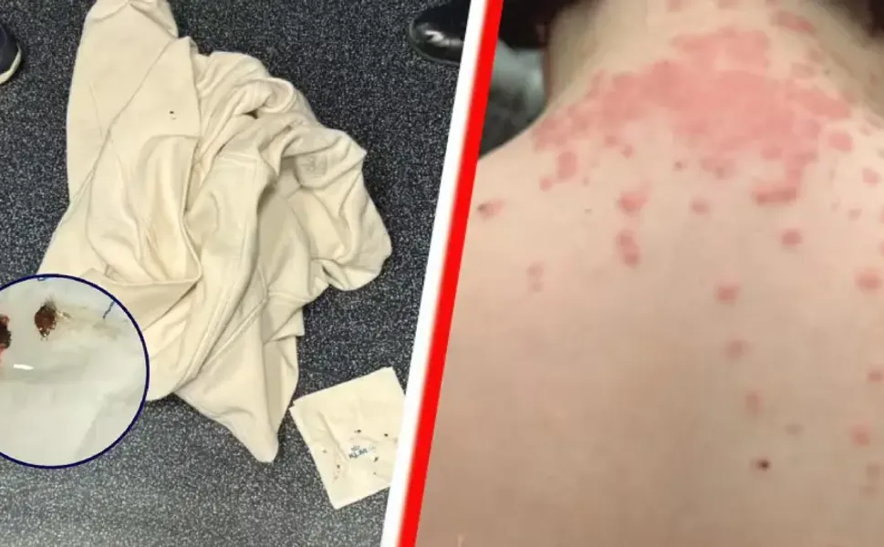 Hollanda aktarmalı uçuşta tahtakurusu iddiasıyla KLM’e 200 bin dolarlık dava